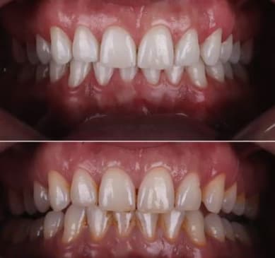 Slider image (4) Smile Zone Clinic